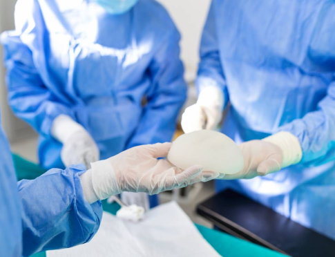 Životnost prsních implantátů: co byste měli vědět před zákrokem